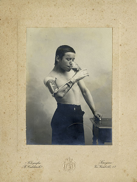 Photographic portrait of an amputee wearing a prosthesis invented by Giuliano Vanghetti, early 20th century.