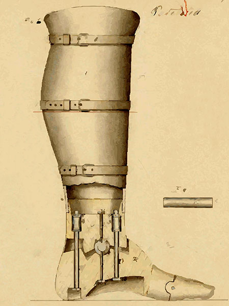 The artificial leg patented by Douglas Bly in 1863.