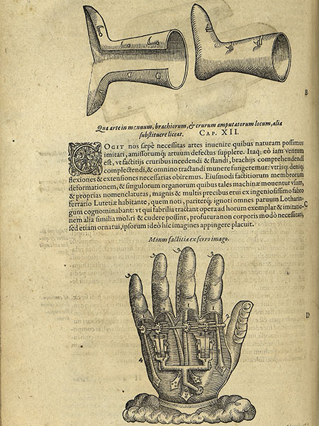 Ambroise Paré’s "Iron Hand", from Dix livres de la chirurgie.