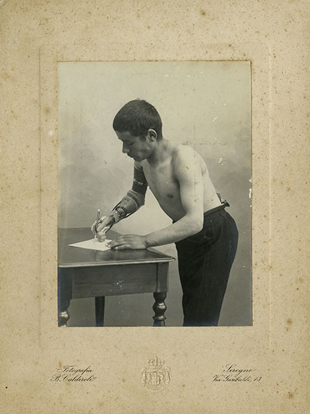 Photographic portrait of an amputee wearing a prosthesis invented by Giuliano Vanghetti, early 20th century.